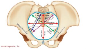 Read more about the article Female Pelvis: True Pelvis and False Pelvis | Landmarks of Female Pelvis | Diameters of Female Pelvis