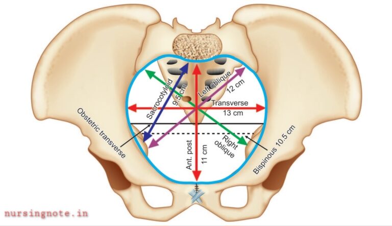 Female Pelvis