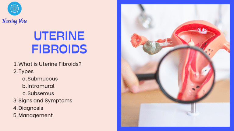 Educational overview of uterine fibroids.