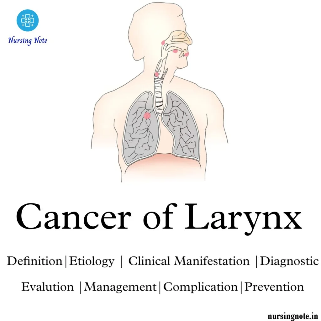 Cancer of Larynx or Laryngeal Cancer - 2nd Year GNM Medical Surgical Nursing II, Oncology Nursing(Definition,Etiology,Sign & Symptoms,Diagnosis,Treatment & Prevention)