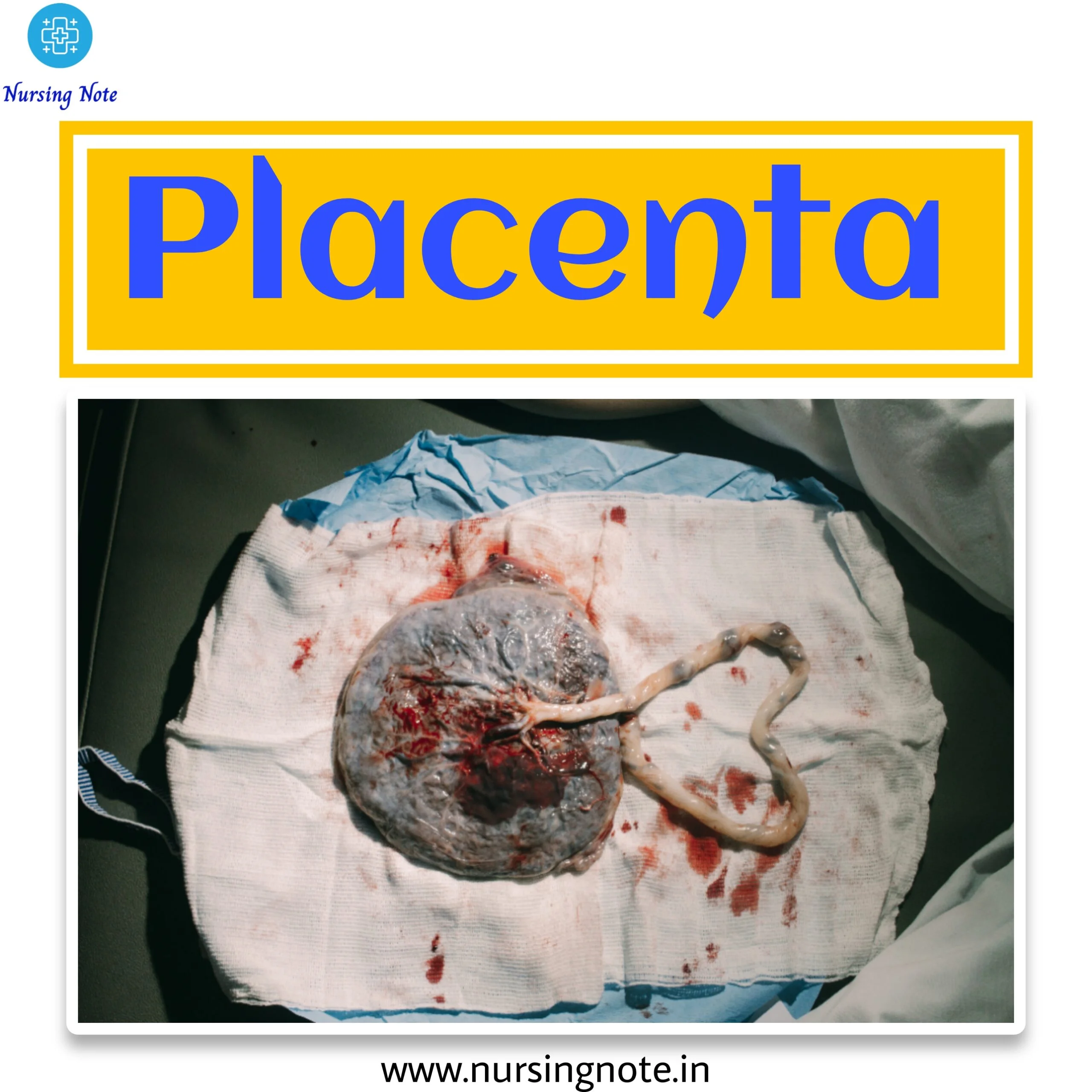 A picture of a placenta